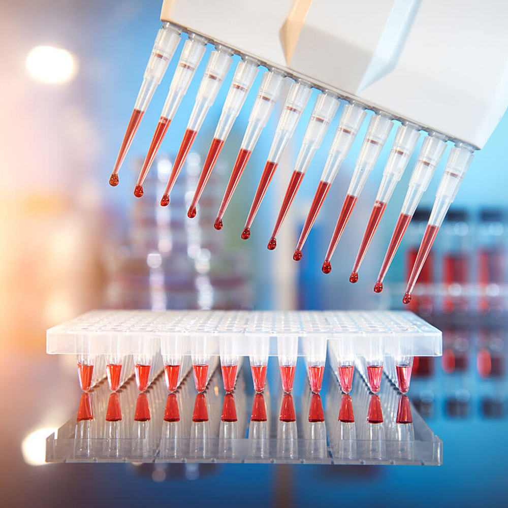 Scientific background. Multichannel pipette tips filled in with reaction mixture to amplify DNA in plastic wells.
